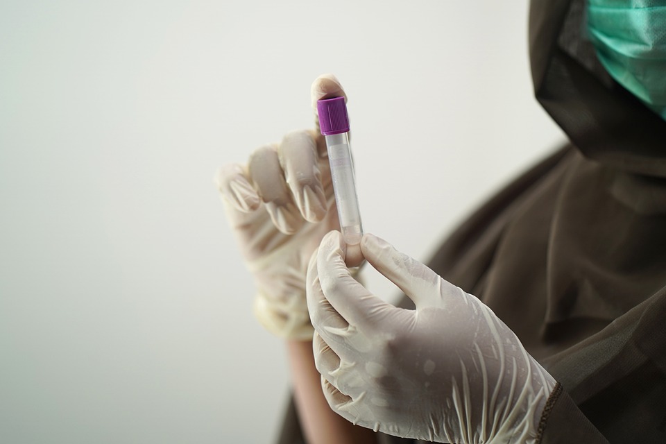 Koronawirus w Holandii: Pilna informacja rządowa! 8 blood test 5601437 960 720